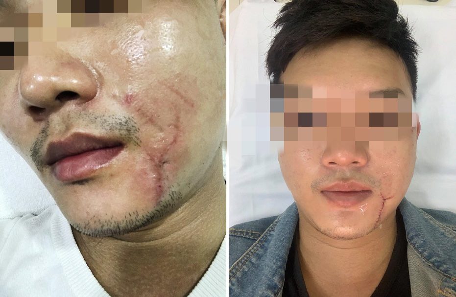 Nhân viên sân bay miệt thị người khuyết tật, chê phục vụ sấp mặt trước đại hội khách ngồi xe lăn - Hình 4