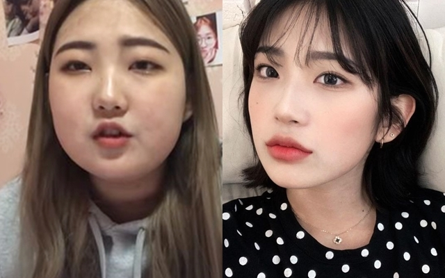 Choi Joon Hee - con gái Jin Sil: Sống bi kịch, bị miệt thị, mắc bệnh và nỗi lo bị bức tử giống mẹ - Hình 10
