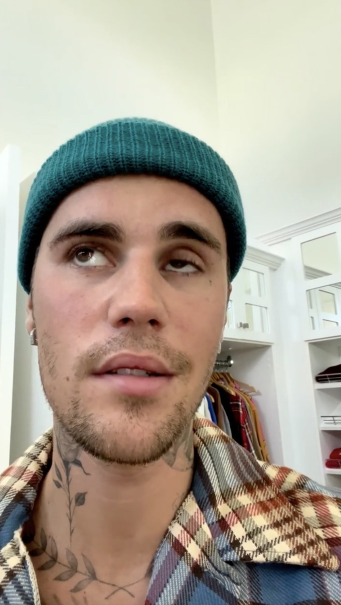 Justin Bieber tiếp tục hủy toàn bộ show diễn vì bệnh liệt mặt trở nặng: Tình trạng đáng báo động - Hình 2