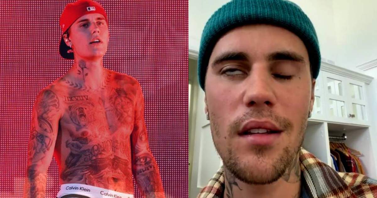 Justin Bieber tiếp tục hủy toàn bộ show diễn vì bệnh liệt mặt trở nặng: Tình trạng đáng báo động - Hình 9