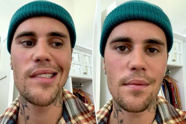 Justin Bieber tàn đời vì Selena Gomez: Tình cũ tiếp tục lôi Hailey vào drama, tương lai mù tịt - Hình 10