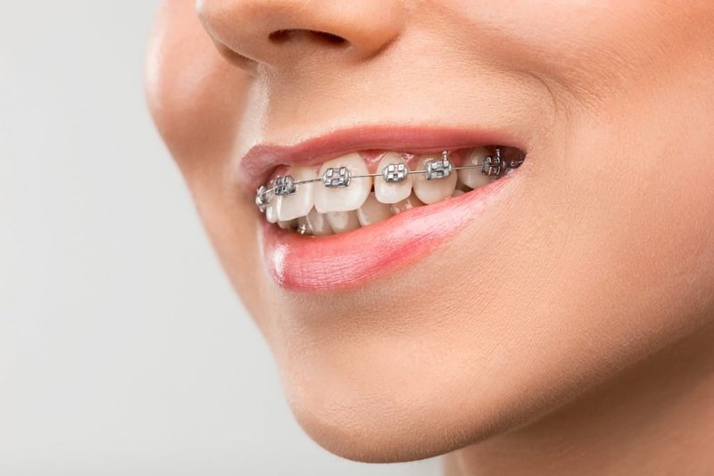 Được bố mẹ đẻ cho 50 triệu niềng răng, vợ bị chồng đòi từ mặt, muốn chiếm riêng tiền lo cho em gái - Hình 2