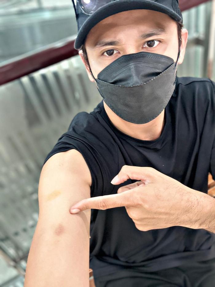 Thúy Diễm đăng đàn tố bị một diễn viên đình đám tác động vật lý, sốc hơn khi nhìn thấy thương tích - Hình 7