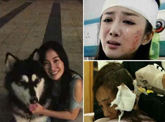 Lý Y Hiểu: Đát Kỷ quyến rũ nhất màn ảnh bị hủy dung nhan vì chó cắn, ra sao sau 9 năm? - Hình 5
