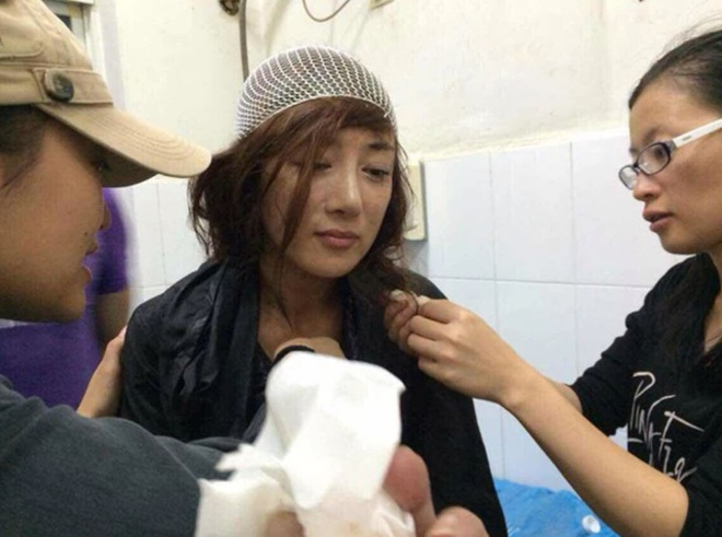 Lý Y Hiểu: Đát Kỷ quyến rũ nhất màn ảnh bị hủy dung nhan vì chó cắn, ra sao sau 9 năm? - Hình 3