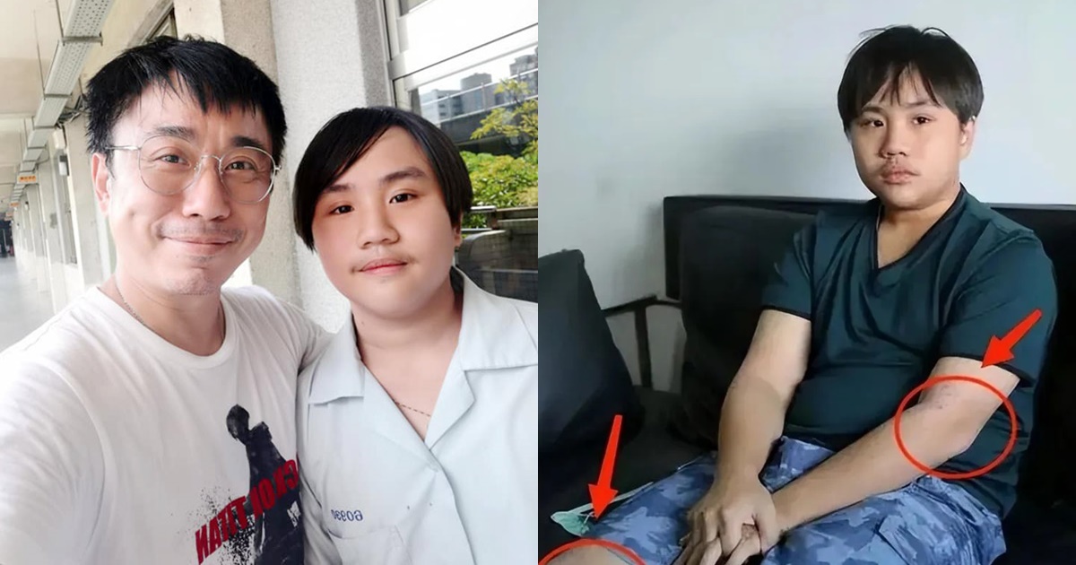 Tiểu Tiểu Bân: Thần đồng diễn xuất, bị cha ruột xem như ATM di động, giờ làm nhân viên vệ sinh - Hình 9