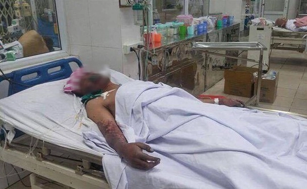 Người đàn ông bị điếc đột ngột sau khi cùng bạn bè ăn món khoái khẩu, chuyên gia lên tiếng cảnh báo! - Hình 3