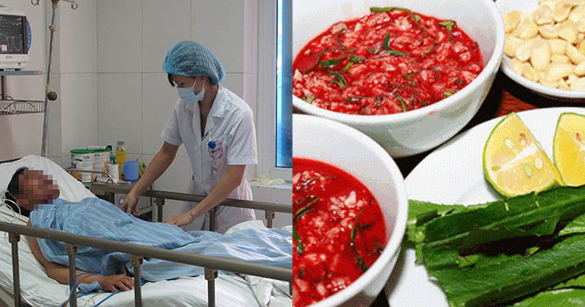 Người đàn ông bị điếc đột ngột sau khi cùng bạn bè ăn món khoái khẩu, chuyên gia lên tiếng cảnh báo! - Hình 6