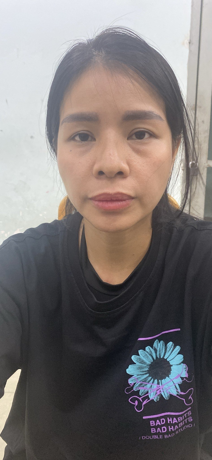 Bé trai 8 tuổi trong vụ bị b.ạo h.ành: Bị đánh đến ảnh hưởng tâm lý, cha thờ ơ trước nỗi đau của con - Hình 2