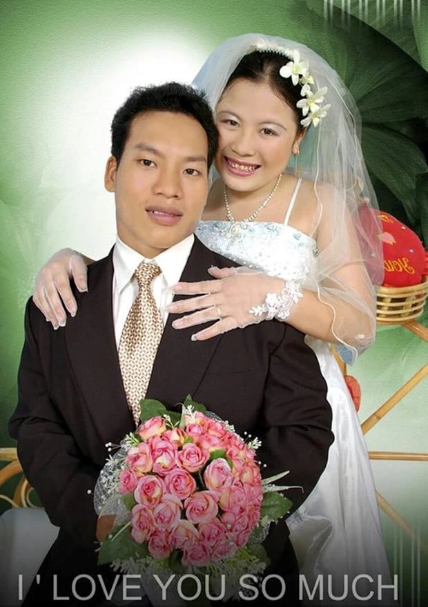 Falling in love with a boy with a birth defect, the 16-year-old girl has an unexpected ending after 15 years of marriage - Photo 3