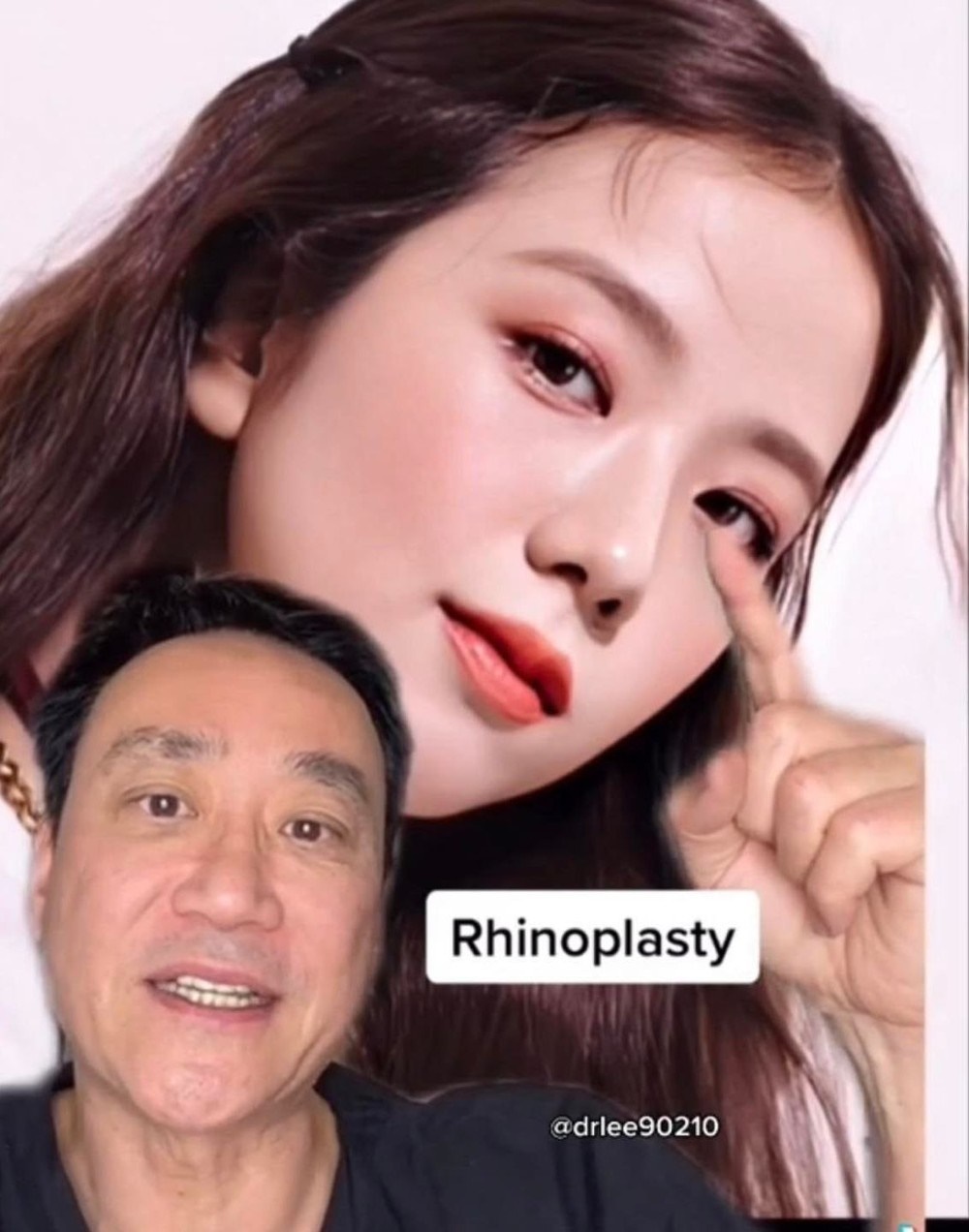 BLACKPINK bị bác sĩ bóc trần chuyện phẫu thuật thẩm mỹ: Lisa sửa gần hết, Rosé tốn hơn nửa tỷ - Hình 2