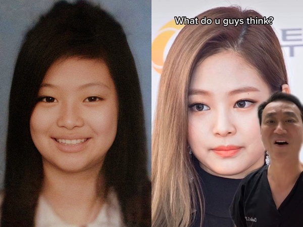 BLACKPINK bị bác sĩ bóc trần chuyện phẫu thuật thẩm mỹ: Lisa sửa gần hết, Rosé tốn hơn nửa tỷ - Hình 5