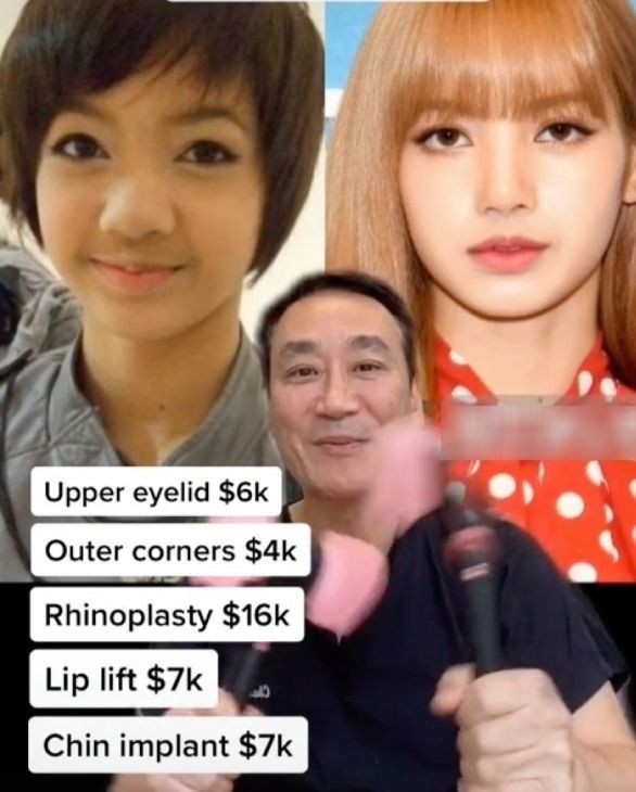 BLACKPINK bị bác sĩ bóc trần chuyện phẫu thuật thẩm mỹ: Lisa sửa gần hết, Rosé tốn hơn nửa tỷ - Hình 7