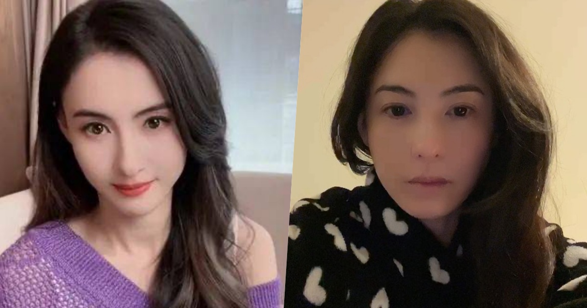 Trương Bá Chi bị ba ruột con trai út tác động vật lý, gương mặt thương tích chằn chịt? - Hình 8