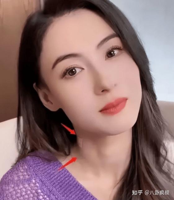 Trương Bá Chi bị ba ruột con trai út tác động vật lý, gương mặt thương tích chằn chịt? - Hình 4