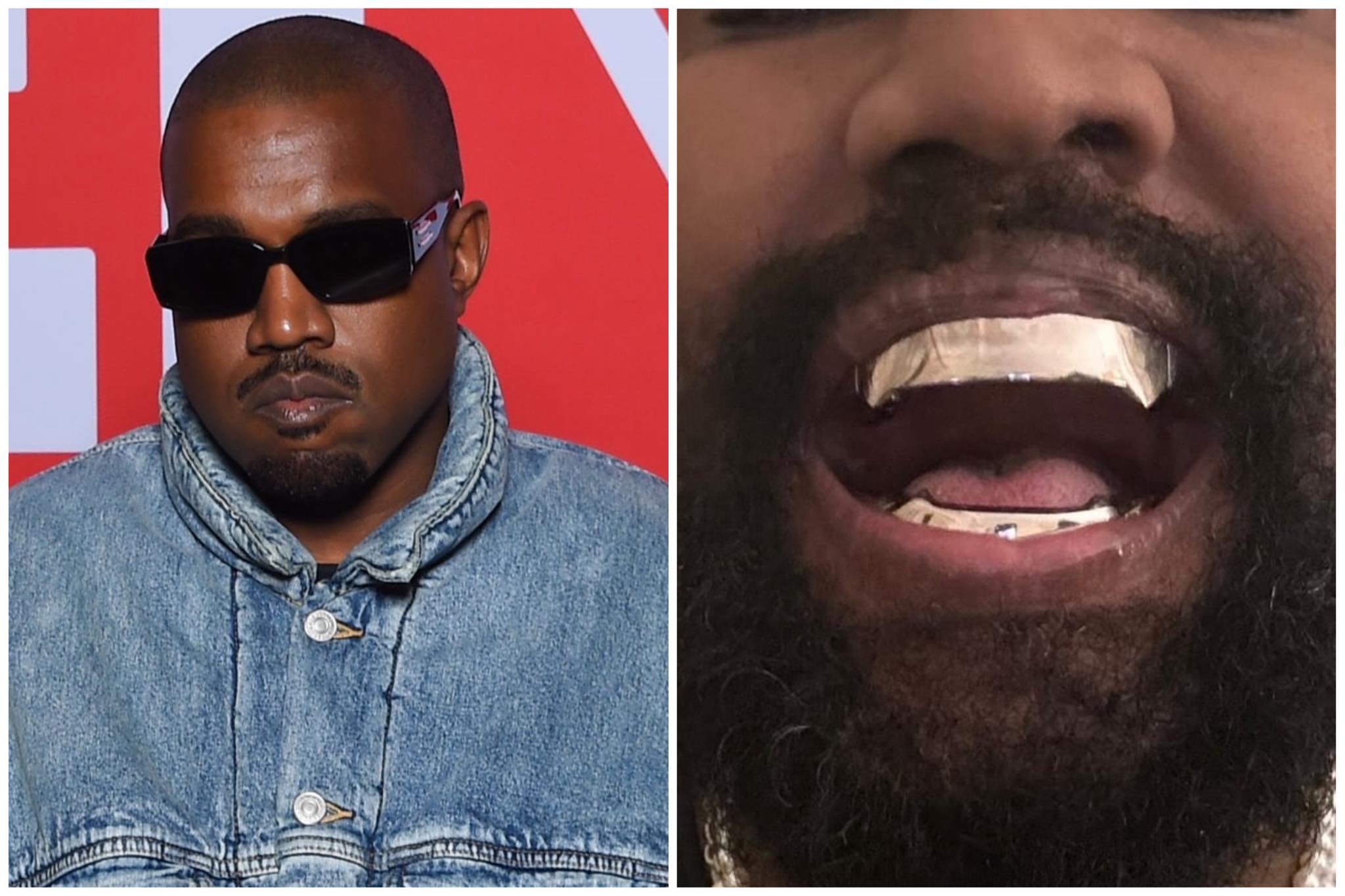 Kanye West has fake teeth worth more than 20 billion VND - Picture 1