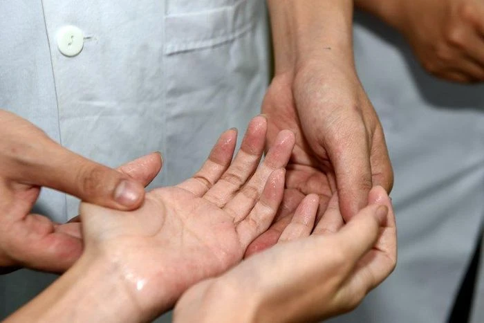 Ra mồ hôi tay nhiều phải làm sao? - Hình 1