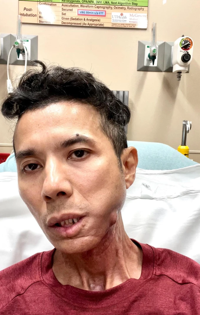 Mẹ Kasim chống chọi với lưỡi thiên hạ, tiết lộ tình trạng sốc của con - Hình 4