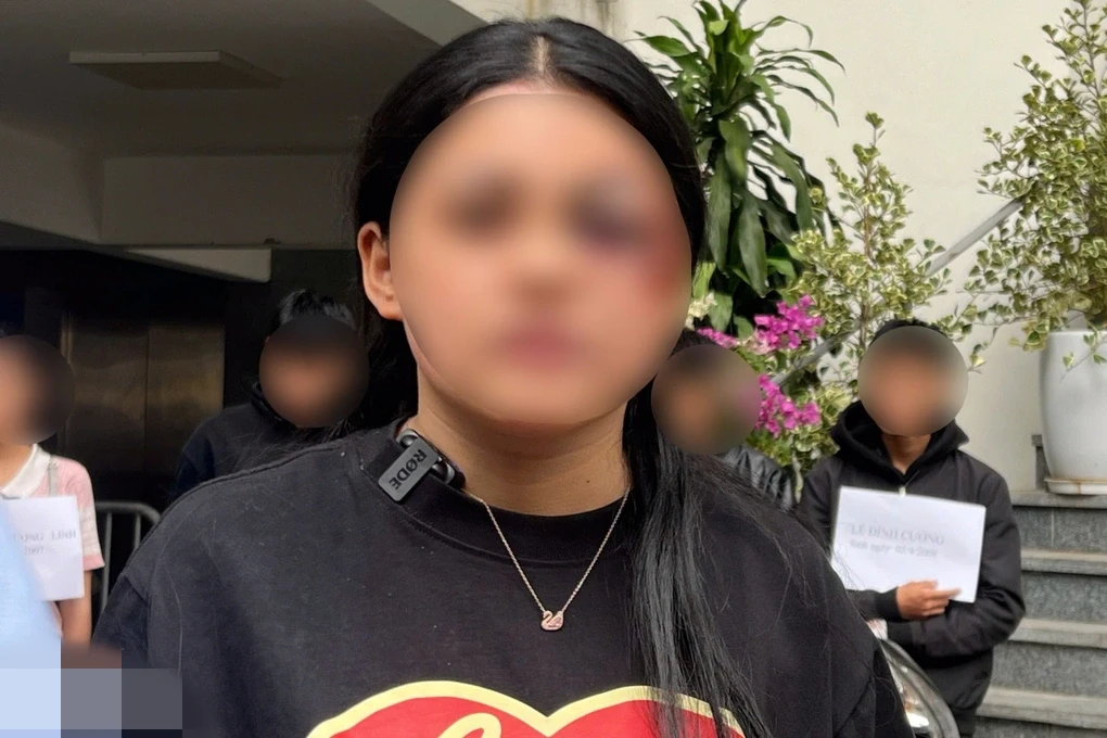 Nữ quái xế tông cô gái trẻ ở Hà Nội: Hoàn cảnh đặc biệt, lời ân hận muộn màng - Hình 3