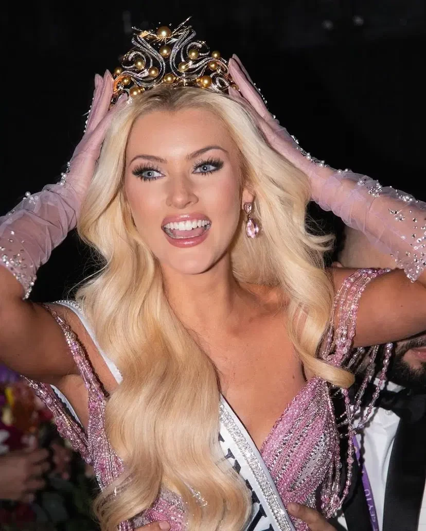 Tân Miss Universe can thiệp dao kéo quá đà, hỏng cả gương mặt, fan nhận không ra - Hình 5