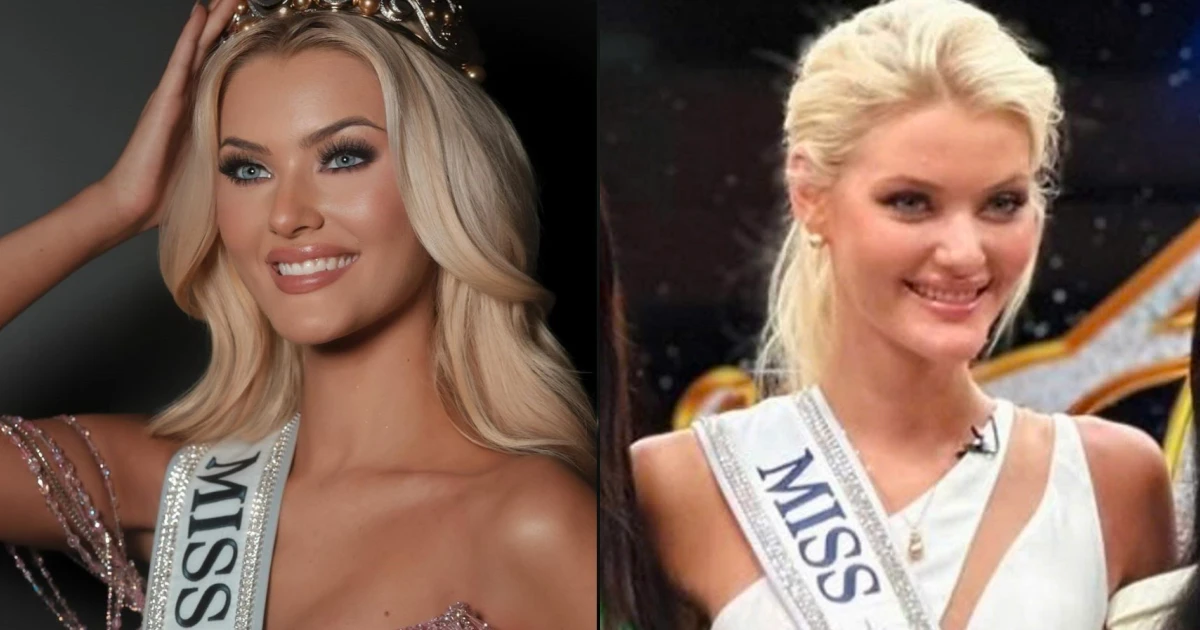 Tân Miss Universe can thiệp dao kéo quá đà, hỏng cả gương mặt, fan nhận không ra - Hình 7