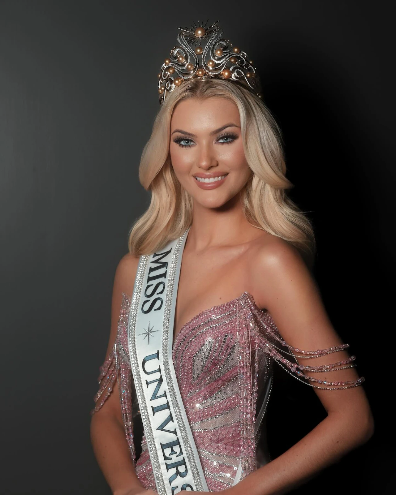Tân Miss Universe can thiệp dao kéo quá đà, hỏng cả gương mặt, fan nhận không ra - Hình 3