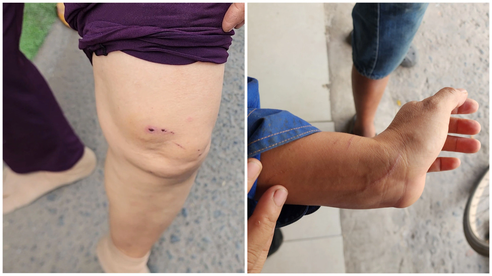 Quận 12: Khỉ đuôi lợn liên tục sổng chuồng cắn người gây thương tích - Hình 3