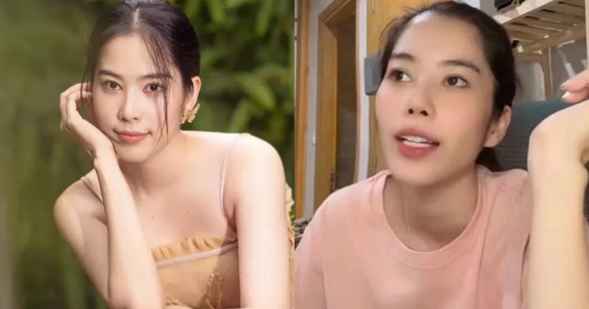 Nam Em tiết lộ lý do gương mặt khác lạ, tức điên vì bị làm điều này lúc hôn mê - Hình 6