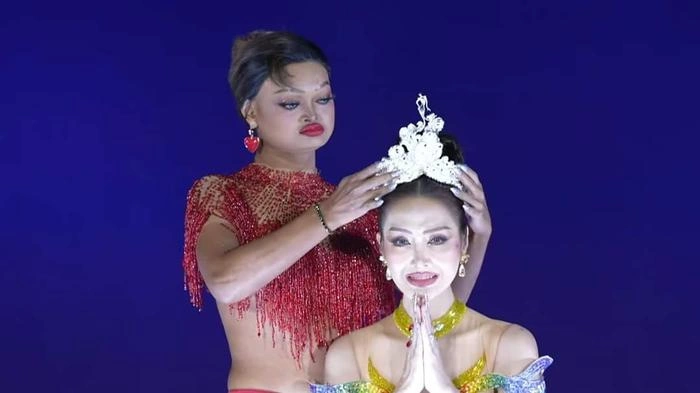 Hoa hậu không tóc, không răng đánh bại Lương Mỹ Kỳ tìm được người kế nhiệm - Hình 1
