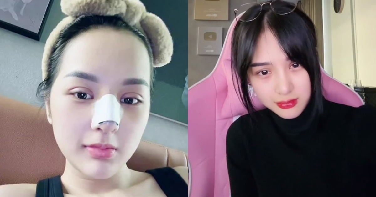 Gấm Kami lộ diện sau khi dao kéo nát mặt, nhan sắc ra sao khiến CĐM tiếc nuối? - Hình 9