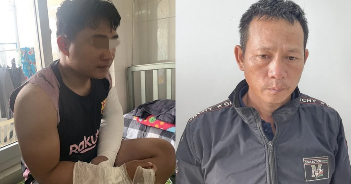 Vụ shipper ở Quảng Ngãi bị đánh gãy hai tay: Kẻ côn đồ sắp hầu tòa, trả giá đắt - Hình 6
