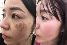 6 thần tượng Hàn Quốc luôn dẫn đầu các xu hướng thời trang - Hình 7
