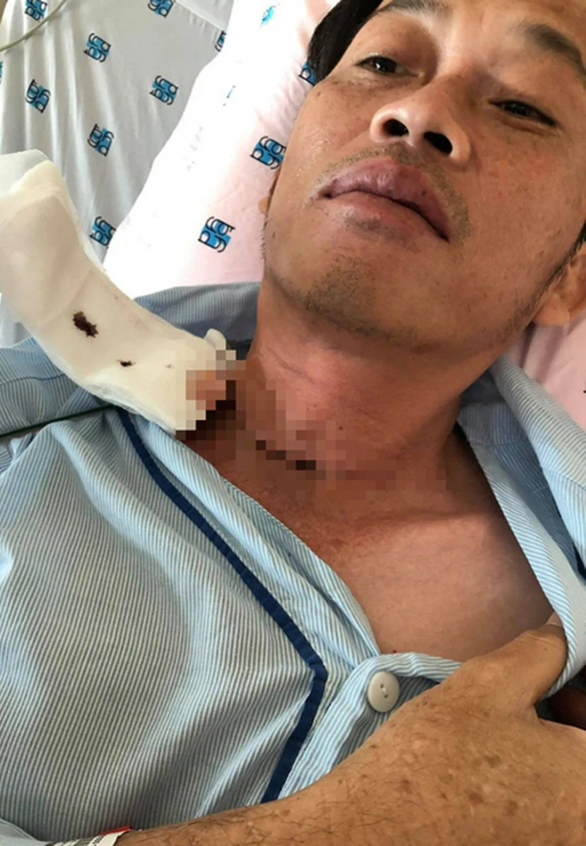 Hoài Linh khác lạ sau 3 năm bị ung thư, sức khỏe thế nào sau tin đồn qua đời? - Hình 2