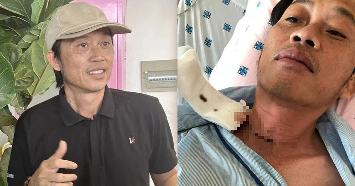 Hoài Linh khác lạ sau 3 năm bị ung thư, sức khỏe thế nào sau tin đồn qua đời? - Hình 8