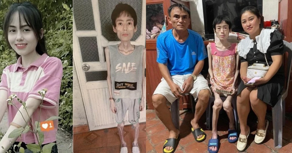 Cô gái Hưng Yên nhịn ăn giảm cân, từ xinh xắn đầy sức sống giờ còn da bọc xương - Hình 6