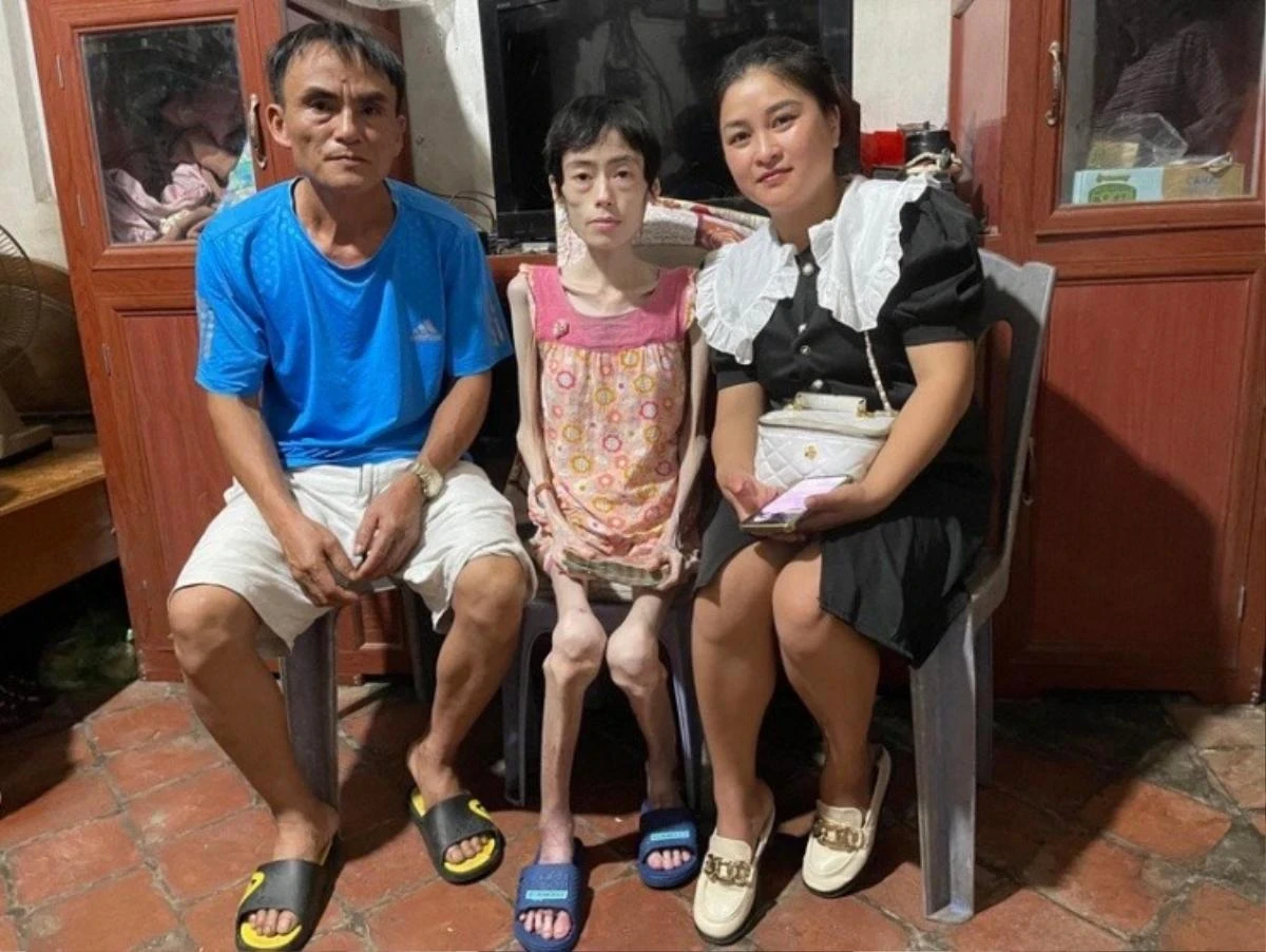 Cô gái Hưng Yên nhịn ăn giảm cân, từ xinh xắn đầy sức sống giờ còn da bọc xương - Hình 5