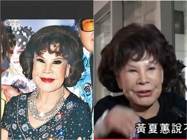 Hoàng Hạ Huệ: Thảm hoạ thẩm mỹ, làm loạn đủ trò, tuổi xế chiều không giống ai - Hình 7