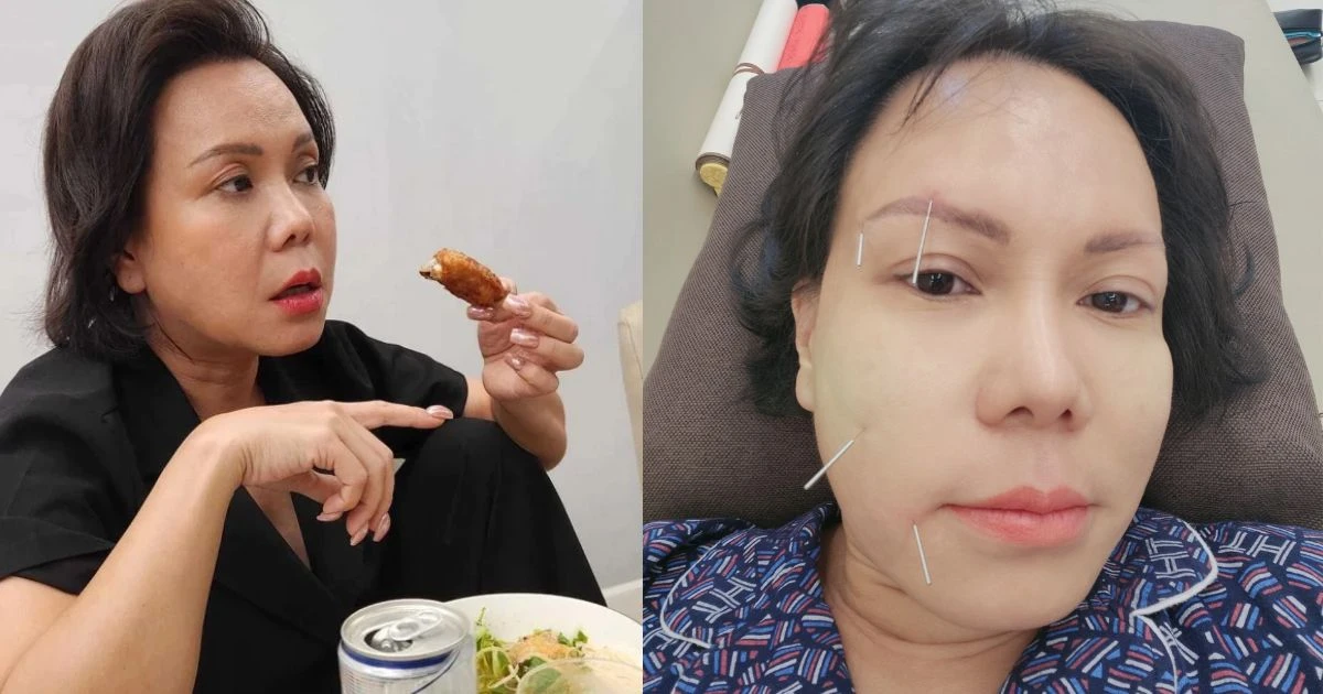 Việt Hương bị biến dạng khuôn mặt, dây thần kinh số 7 co rút, trầm cảm vì phim - Hình 7