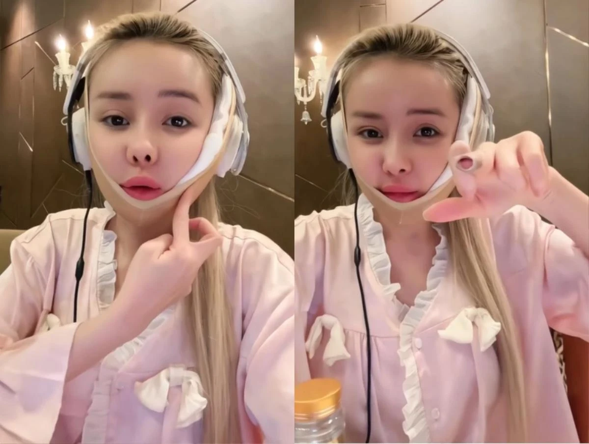 Ngân 98 mặt băng bó, vẫn chưa khá hơn sau sự cố, được chú Quang tặng cho 1 thứ - Hình 1