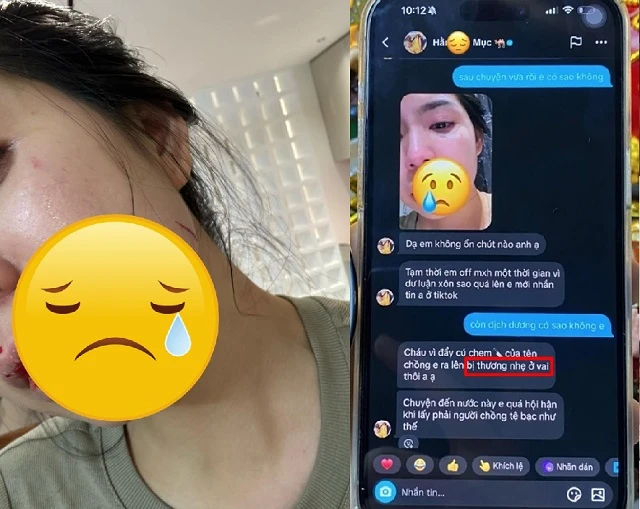 Chồng Hằng Du Mục vui mừng rời trại giam, thái độ như nắm chắc phần thắng? - Hình 3
