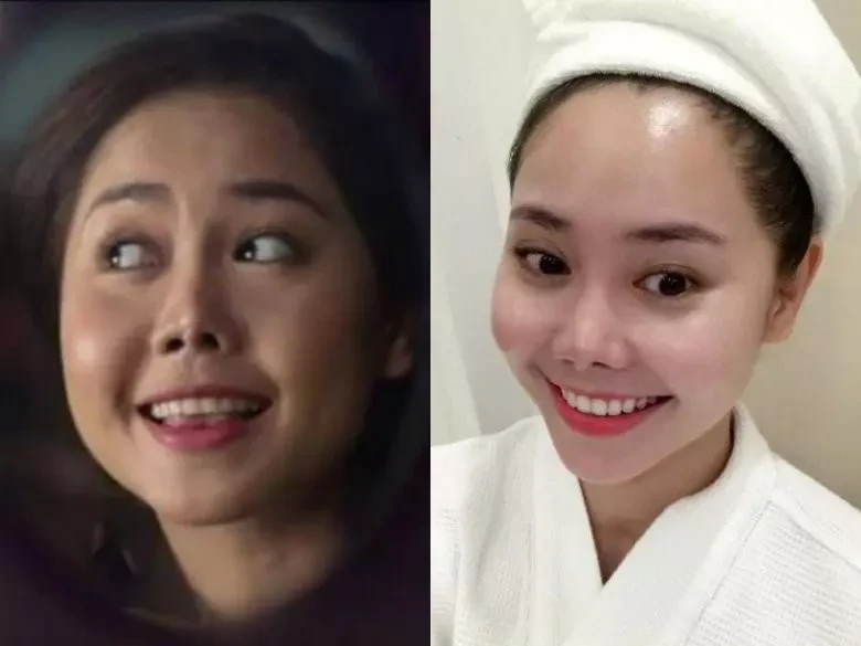 Tường Vi bị biến dạng mũi vì dao kéo, đến Ngân 98 vẫn thấy may mắn hơn? - Hình 4