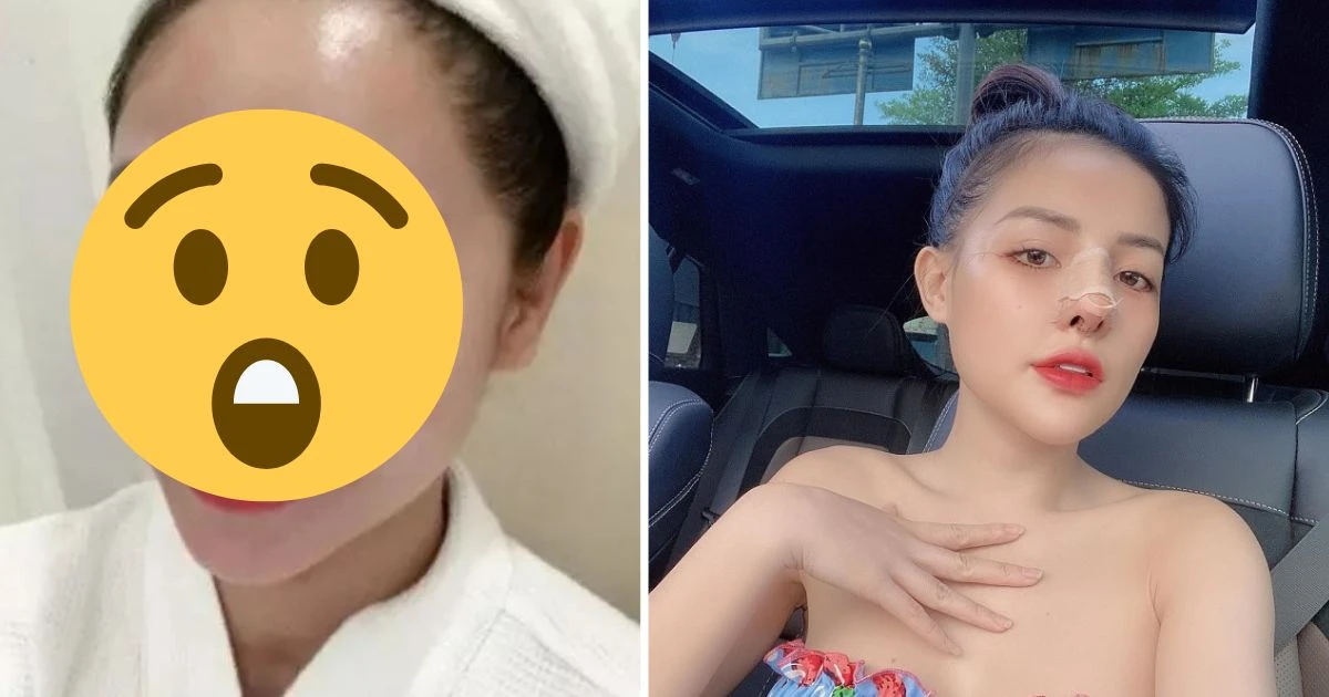 Tường Vi bị biến dạng mũi vì dao kéo, đến Ngân 98 vẫn thấy may mắn hơn? - Hình 11