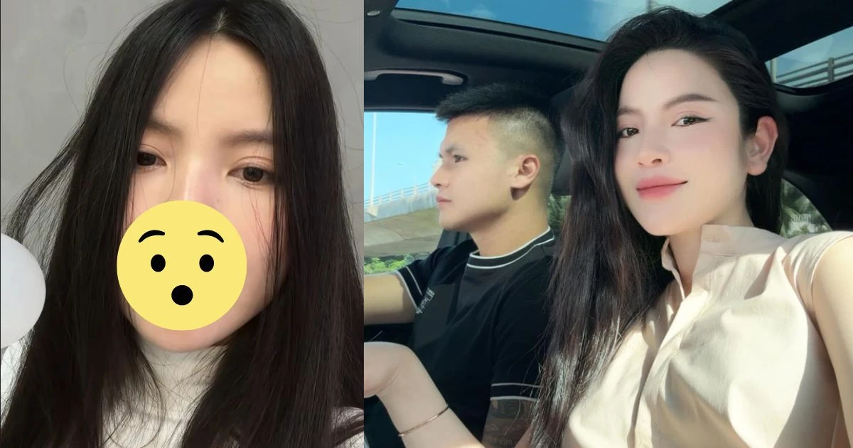 Vợ Quang Hải môi sưng phù, biến dạng sau tái thẩm mỹ, không dám gặp chồng con - Hình 8