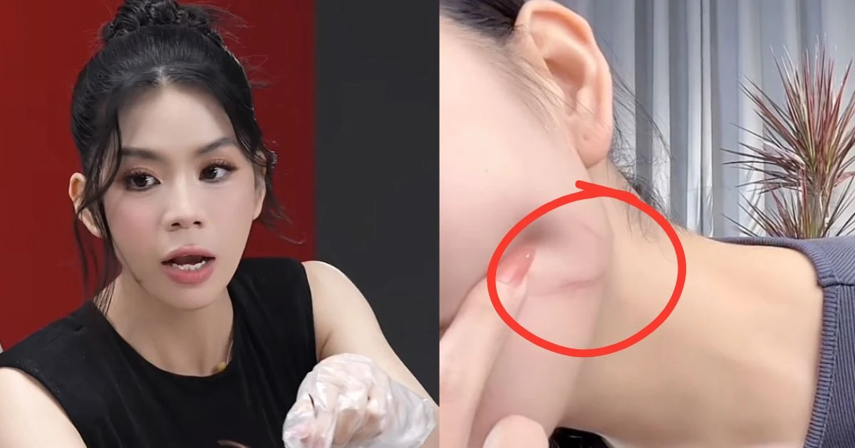 Hằng Du Mục show cận vết sẹo trên live, đáp trả lời tố makeup để câu thương hại - Hình 7