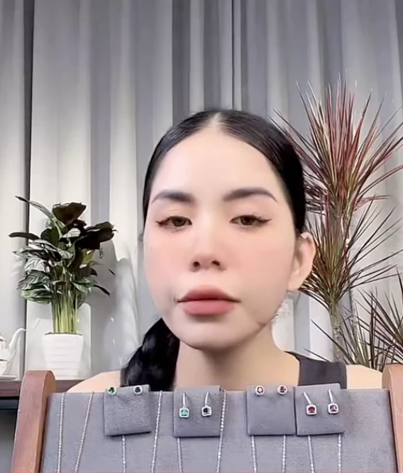 Hằng Du Mục show cận vết sẹo trên live, đáp trả lời tố makeup để câu thương hại - Hình 6