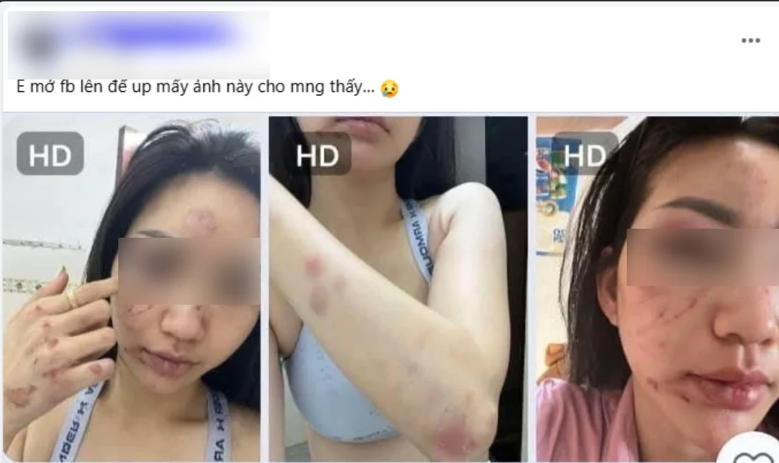 Vụ bắt ghen cô gái ngân hàng: Bé ba lộ tình hình mới, chị vợ hết đường lui? - Hình 6