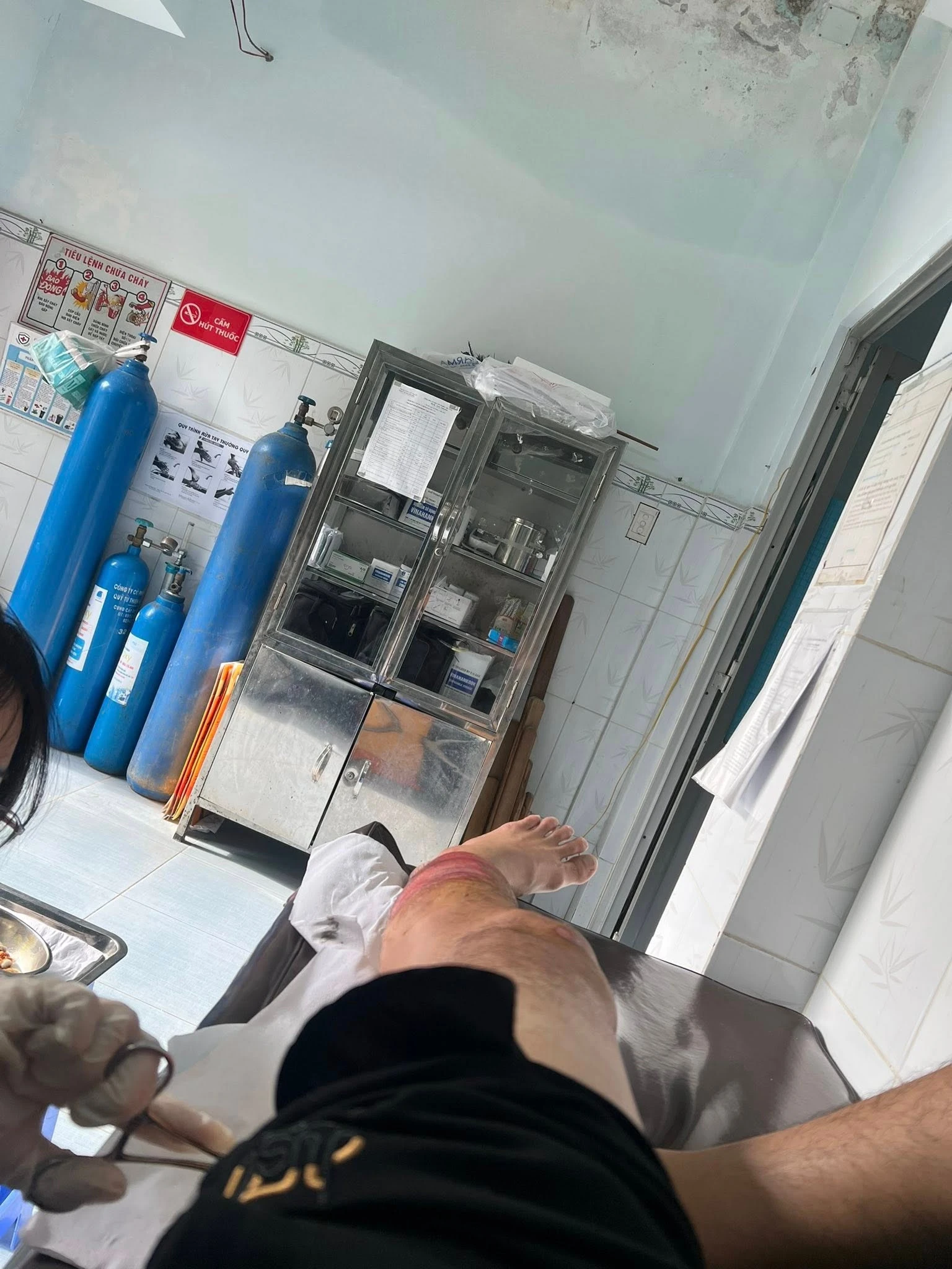 Quách Ngọc Tuyên gặp tai nạn trên đường đi quay phim, thoát chết gang tấc - Hình 2