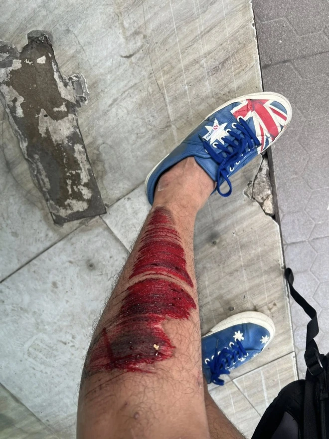 Quách Ngọc Tuyên gặp tai nạn trên đường đi quay phim, thoát chết gang tấc - Hình 1