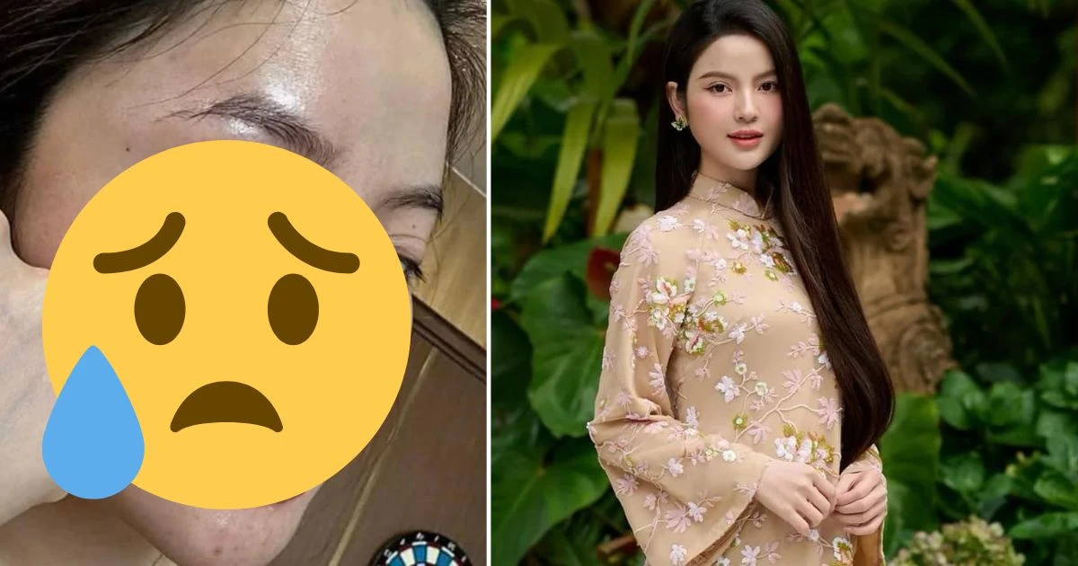 Vợ Quang Hải lộ mặt chi chít vết thương, CĐM sợ không nghĩ cùng 1 người? - Hình 12