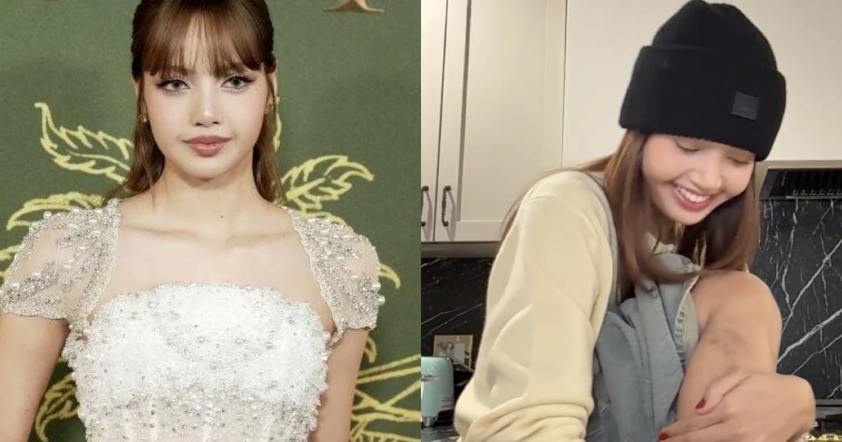 Lisa lộ vết thương lớn ở chân, fan lo sốt vó, báo Mỹ cho lên sóng vì 1 lý do - Hình 7